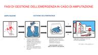 Immagine: FASI DI GESTIONE DELL'EMERGENZA IN CASO DI AMPUTAZIONE = disegni amputazione mano = autore Claudio Calia 2020 || Cfr. «In tempi record, chirurghi dellfOspedale di Padova reimpiantano la mano destra di un 64enne recisa a livello distale dellfavambraccio; lfeccezionale intervento è riuscito.» = [17 Giugno 2020 - Azienda Ospedaliera di Padova - aopd.veneto.it]